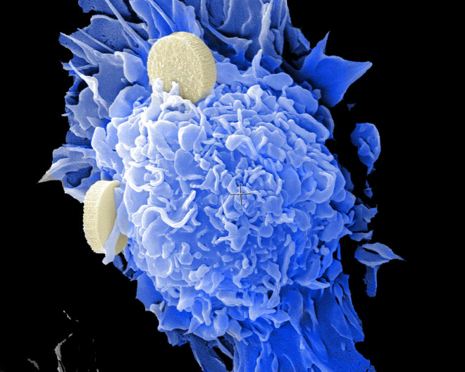 Axit béo tấn công tế bào ung thư - ảnh đồ họa: Unsplash/CC0 Public Domain