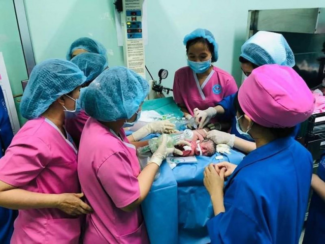 Các bác sĩ Bệnh viện Hùng Vương đón hai bé song sinh dính nhau chào đời. Ảnh: BVCC