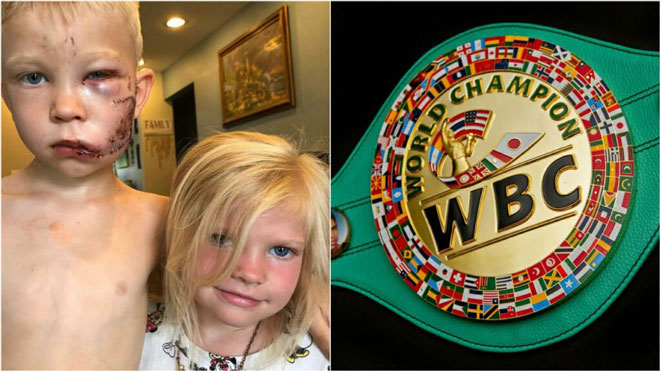 Cậu bé dũng cảm cứu em gái được trao đai danh dự boxing WBC&nbsp;
