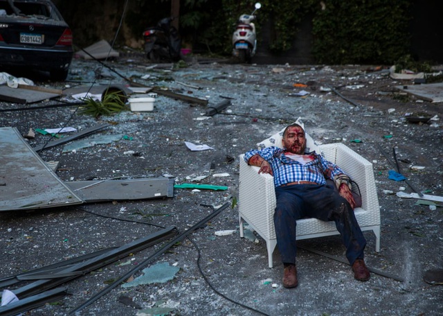 Một người dân ở Beirut bị thương chán nản nhìn cơ ngơi của mình ra tro sau vụ nổ (ảnh: Reuters)