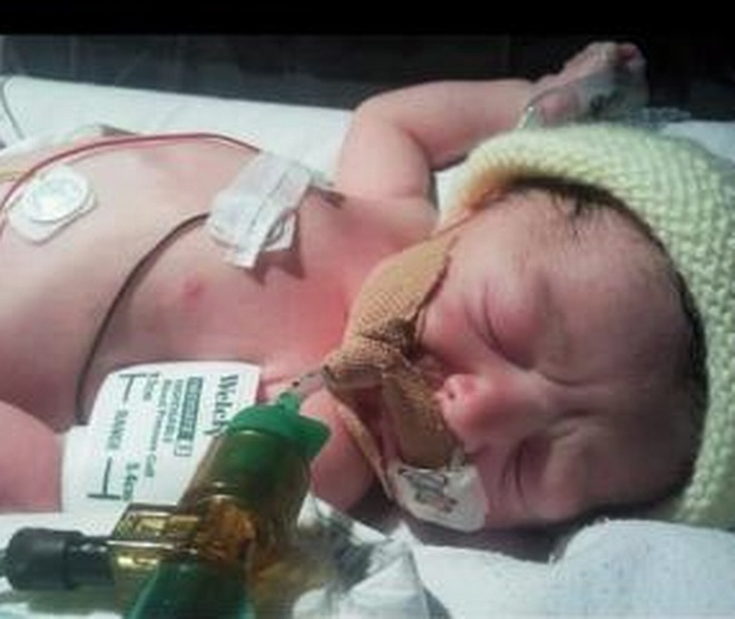 Cô bé Maisy Vignes chào đời nhưng không có một giọt máu trong cơ thể.