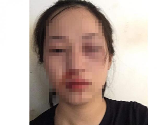 Công an lên tiếng về việc CSGT bị tố "dùng dùi cui vụt vào mặt người phụ nữ vi phạm"