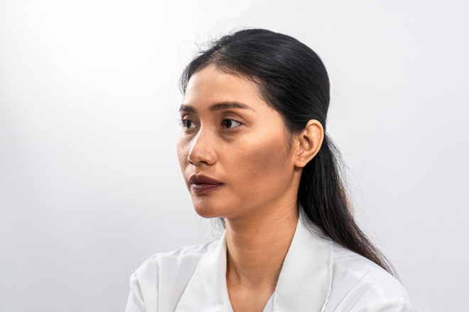 Đôi má hóp, thần thái dương lõm sâu và mắt thâm quầng khiến Thu Hòa kém duyên