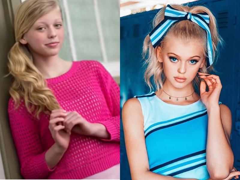 Có tin đồn liên quan đến đến việc&nbsp;Loren Gray đã tiến hành bơm môi.