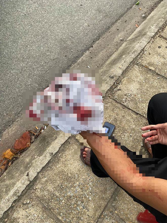 Sau khi tài xế taxi Mai Linh bị đánh chảy máu đầu, nhóm người đi trên xe taxi Vinasun còn hùng hổ đuổi tới đòi đánh tiếp và buông những lời hăm dọa.
