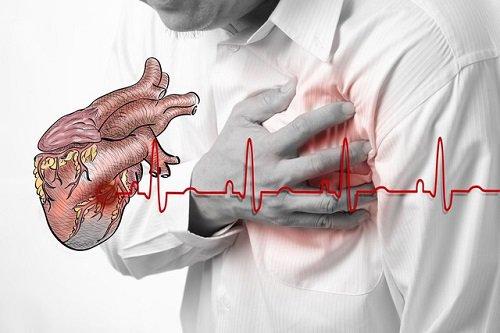 Cao huyết áp có thể gây nhiều biến chứng nguy hiểm