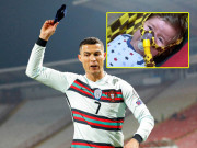 Bóng đá - Băng đội trưởng bị Ronaldo ném đi, được bán gần 2 tỷ đồng cứu sống bệnh nhân nhí