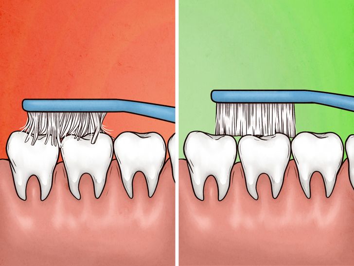 Bạn có đang chải răng quá mạnh? 8 lưu ý sau sẽ giúp răng vừa khỏe vừa đẹp - 5