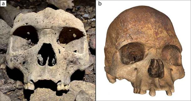 Hộp sọ với phần răng hàm đã được phẫu thuật để loại bỏ - Ảnh: Antiquity