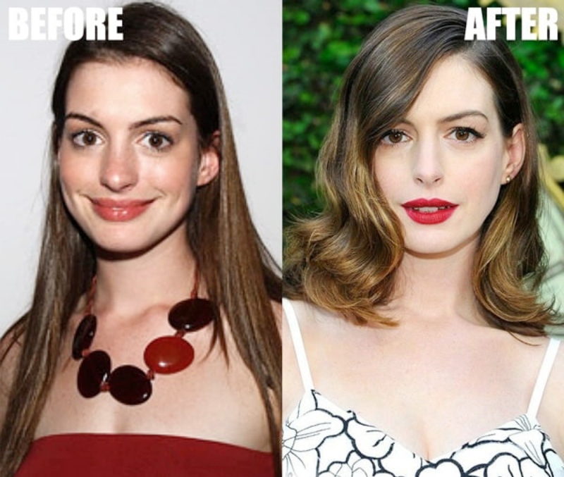 So với ảnh quá khứ, mũi của Anne Hathaway thon gọn, thanh thoát hơn.