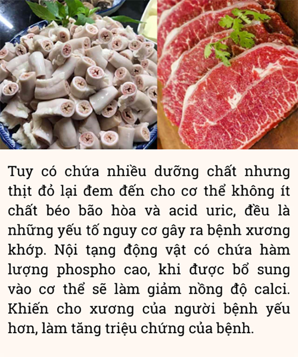 4 thực phẩm “đại kỵ” với người bị đau nhức xương khớp, nên tránh xa ngay hôm nay! - 4