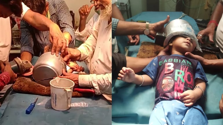 Một cậu bé bị kẹt đầu trong nồi áp suất đã được các bác sĩ ở Agra cứu sống (Ảnh: India Today / Siraj Qureshi)