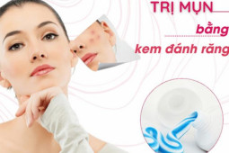 Cách trị mụn cám tận gốc an toàn hiệu quả nhanh nhất tại nhà