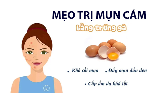 Cách trị mụn cám tận gốc an toàn hiệu quả nhanh nhất tại nhà - 2