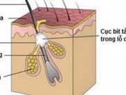 Làm đẹp - Cách làm sạch và ngăn ngừa tắc lỗ chân lông