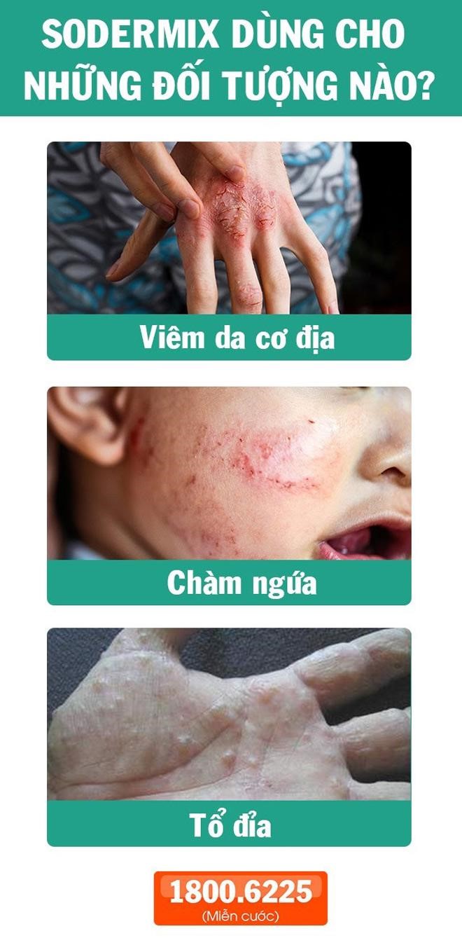 Viêm da chữa mãi không khỏi, Phó Giáo Sư mách mẹo này “mừng như bắt được vàng” - 6