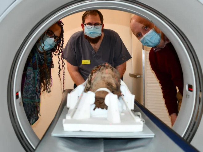 Các nhà khoa học bên chiếc đầu người đang được đưa vào máy CT - Ảnh: ĐẠI HỌC CANTEBURY CHRIST CHURH/ BỆNH VIỆN MAIDSTONE