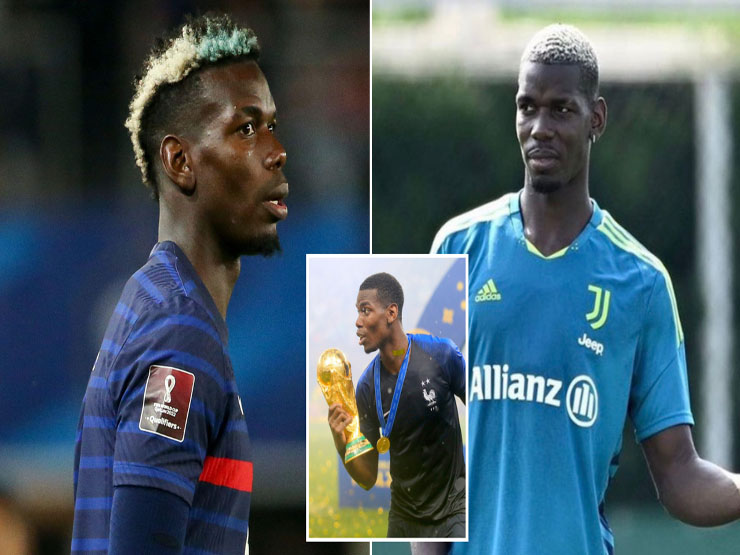 Tin mới nhất bóng đá tối 3/8: Pogba từ chối phẫu thuật vì World Cup 2022