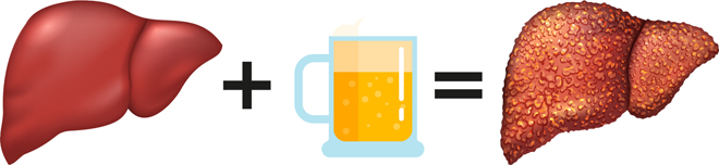 Sử dụng bia, rượu thường xuyên có thể làm tổn thương gan nghiêm trọng.