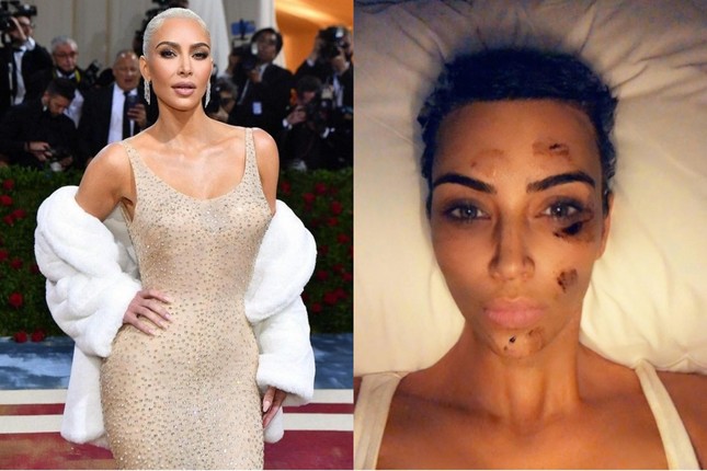 4 phương pháp làm đẹp đau đớn của Kim Kardashian: &#34;Mặt nạ ma cà rồng&#34; gây khiếp sợ - 1