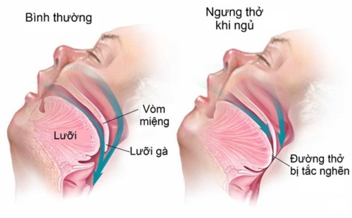 Người thích uống rượu trước khi ngủ nên biết 4 nguy cơ với sức khỏe được chuyên gia cảnh báo - 4