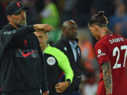 Bóng đá - Liverpool âu lo đấu MU: Klopp tiết lộ dễ phải đổi kế hoạch chuyển nhượng