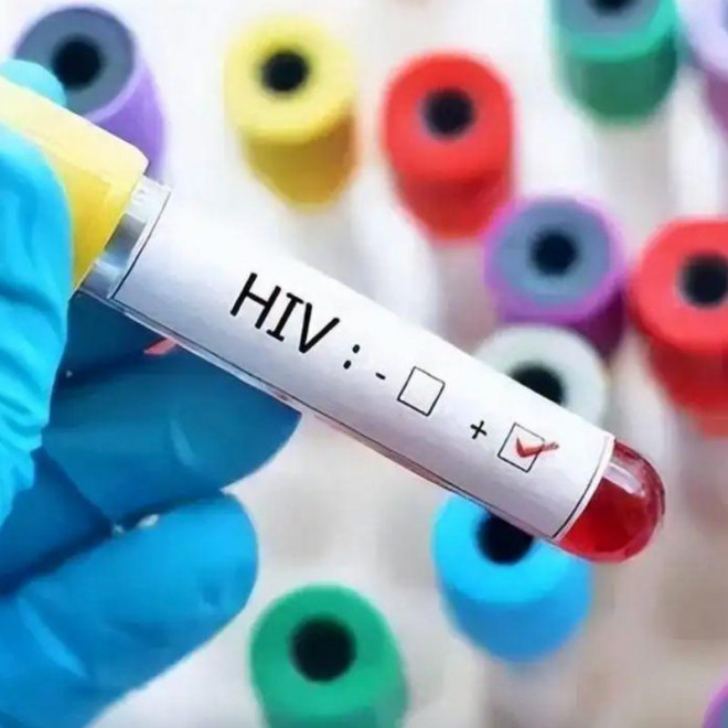 Thanh niên suy sụp vì xét nghiệm dương tính với HIV, 5 năm sau phát hiện sự thật gây sốc - 1