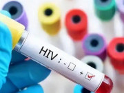 Bạn trẻ - Cuộc sống - Thanh niên suy sụp vì xét nghiệm dương tính với HIV, 5 năm sau phát hiện sự thật gây sốc