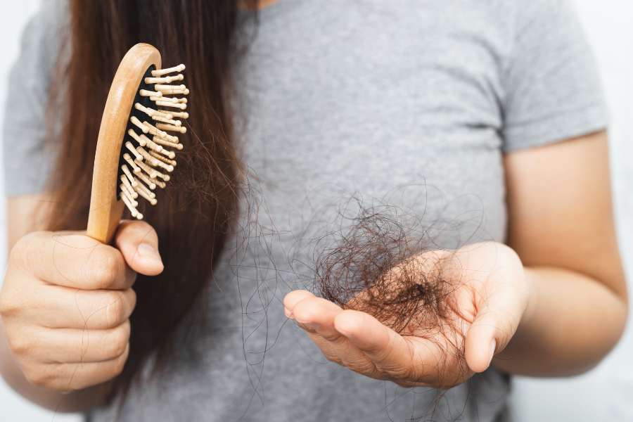 Tóc rụng trên 100 sợi mỗi ngày được gọi là rụng tóc bệnh lý