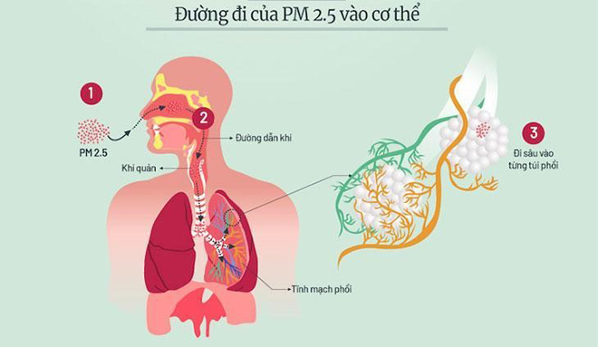 Kẻ thù của người bệnh đờm, ho, khó thở cần tránh xa - 1