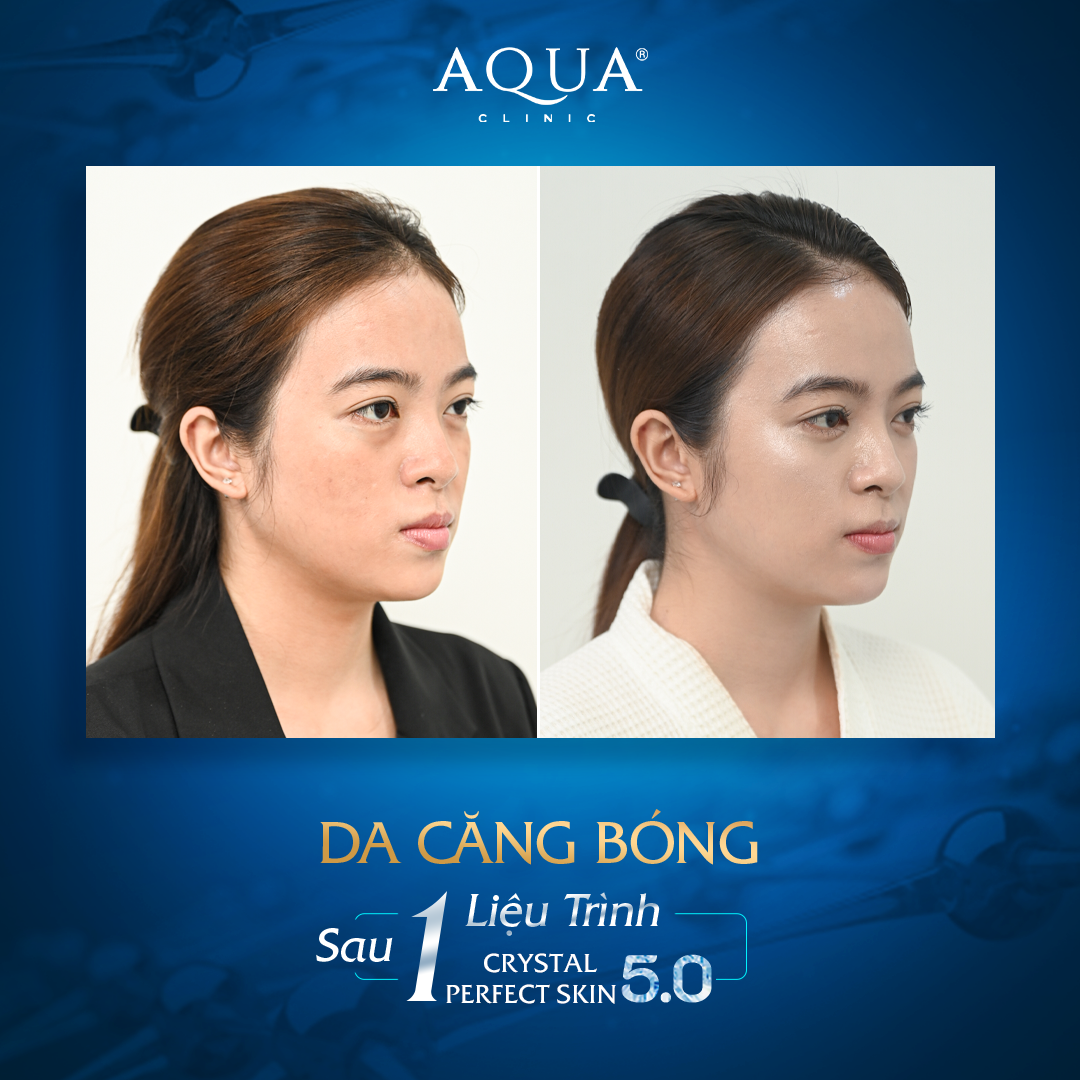 Aqua Clinic ra mắt siêu công nghệ căng bóng da hiện đại - 2