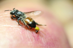Cách sơ cứu khi bị ong đốt: Những điều ai cũng phải biết