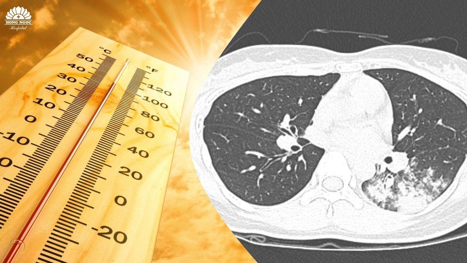 Thời tiết nắng nóng, số ca mắc viêm phổi tăng đột biến ở cả người lớn và trẻ em - 1