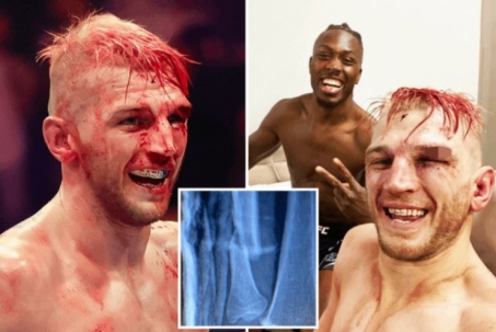 UFC cực nóng: Võ sỹ đánh bại "Thần chết", gãy xương tay vẫn đánh đến cùng
