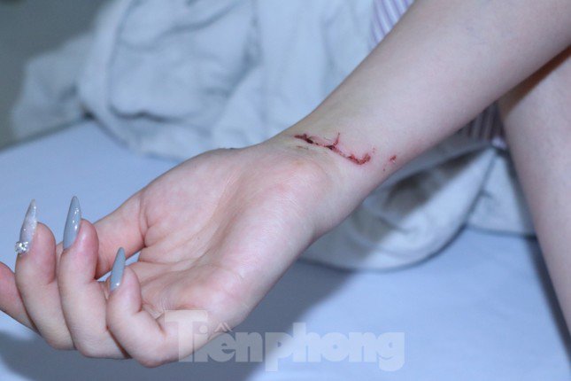 Hé lộ nguyên nhân người đàn ông cầm ghế đánh tới tấp vào đầu cô gái - 3