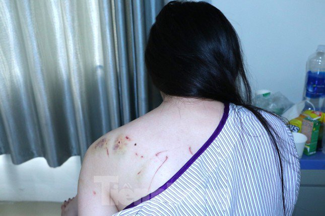 Hé lộ nguyên nhân người đàn ông cầm ghế đánh tới tấp vào đầu cô gái - 4