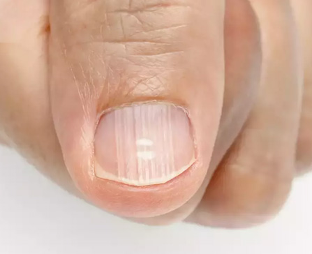 Thấy 5 dấu hiệu này ở bàn chân bạn nên chụp CT gan sớm - 7