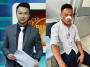 Đời sống Showbiz - Cựu MC “Chào buổi sáng” VTV1 bị tai nạn giao thông nặng ảnh hưởng đến khuôn mặt