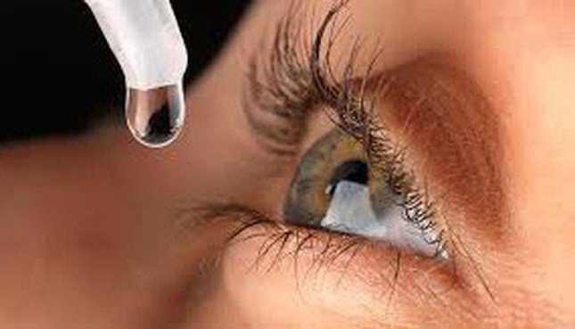 Sai lầm khi sử dụng thuốc nhỏ mắt có thể khiến bạn mù lòa - 2