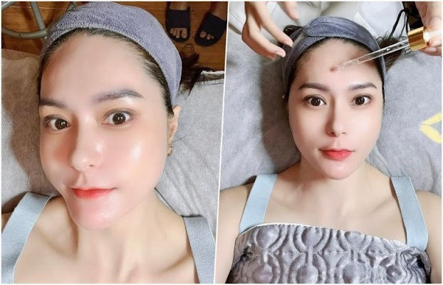 Nữ đại gia quận 7 chi nửa tỷ cấy filler mặt, ngoài đời không &#34;ngán&#34; đọ sắc hoa hậu - 3