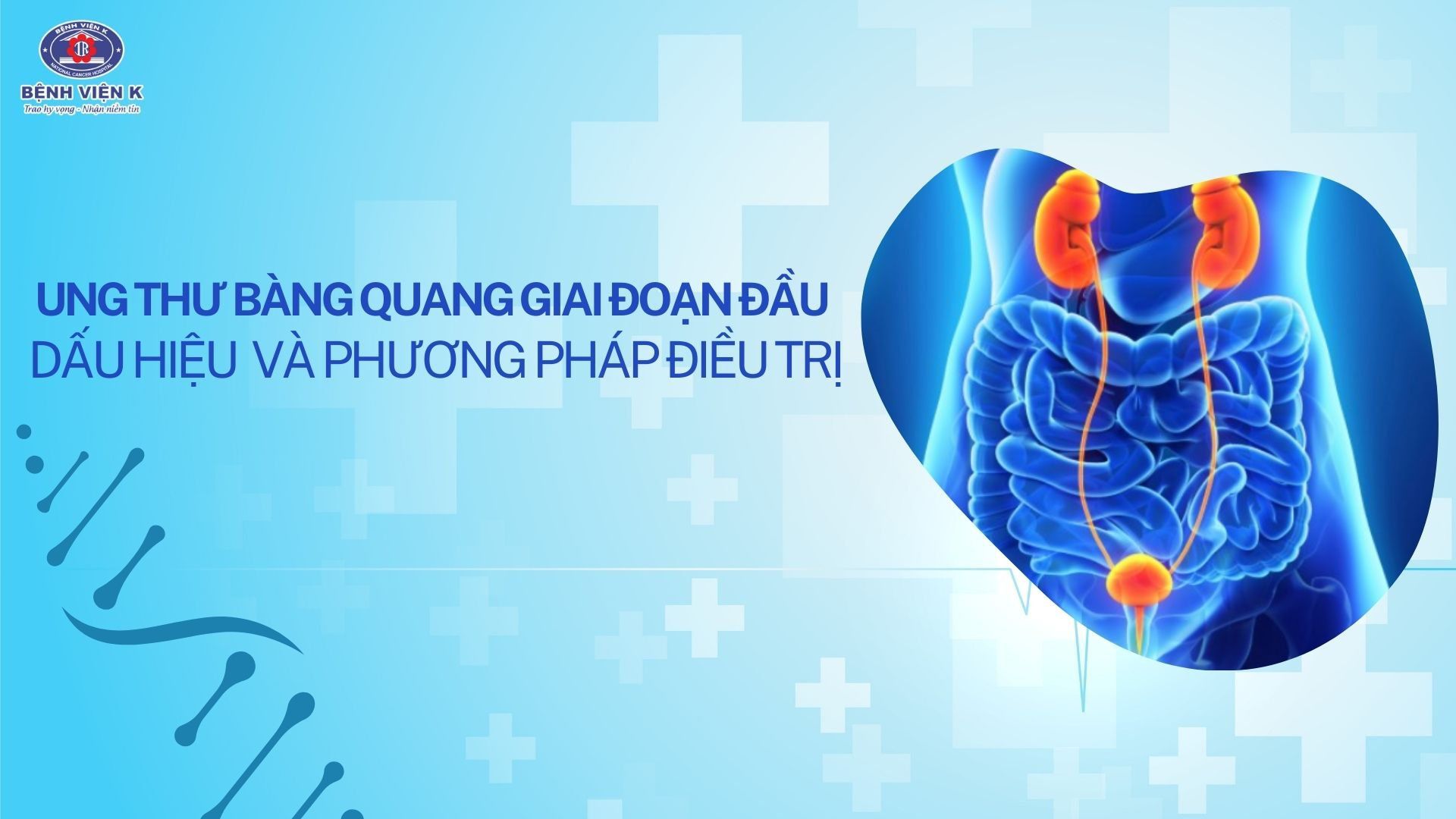 Dấu hiệu nhận biết ung thư bàng quang giai đoạn đầu - 1