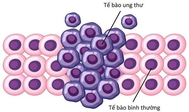 Sự khác nhau giữa tế bào ung thư và tế bào bình thường.