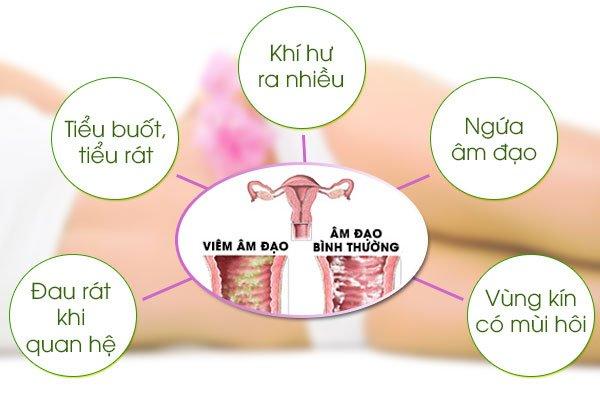 Một số triệu chứng của viêm âm đạo ở phụ nữ