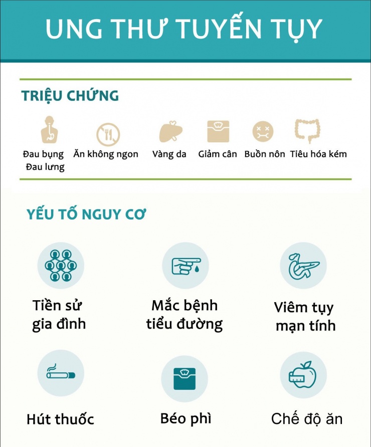Các triệu chứng và yếu tố nguy cơ của ung thư tuyến tụy. Ảnh: Vanderbilt Health
