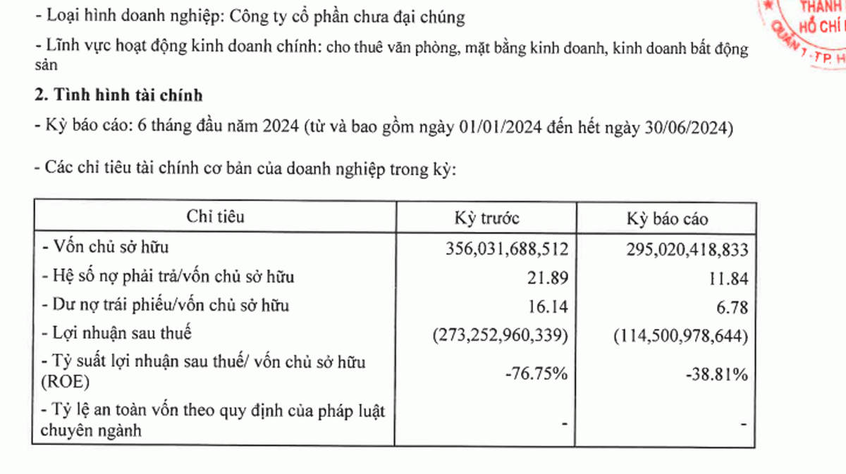 Setra lỗ nặng trong nhiều năm qua.