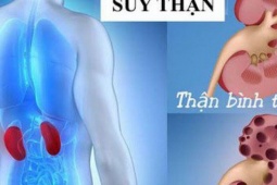 Có 3 dấu hiệu này, thanh niên 24 tuổi ở Phú Thọ đi khám bàng hoàng phát hiện suy thận giai đoạn cuối