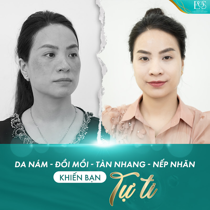 Vì sao dùng nhiều loại viên uống sáng da nhưng không hết sạm nám, nếp nhăn? - 1