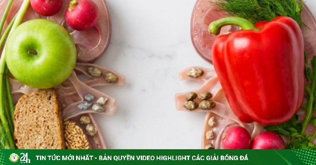 3 bí quyết ăn uống đơn giản giúp ngăn ngừa sỏi thận