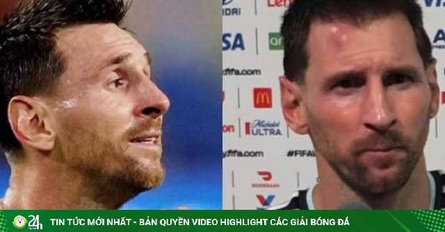 Messi 'sứt đầu mẻ trán', rưng rưng bật khóc vì đối thủ vô danh