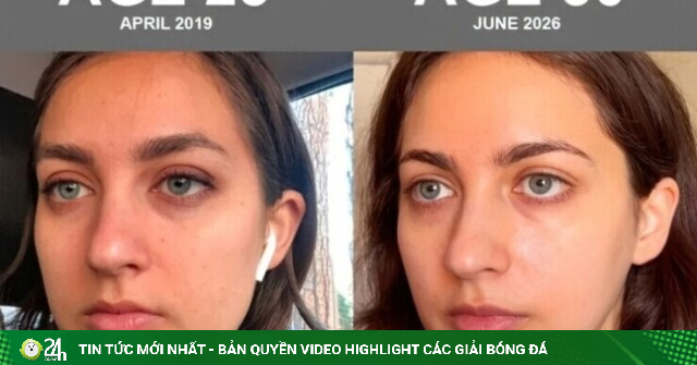 Điều giúp cô gái 30 tuổi có làn da lão hóa ngược 9 năm